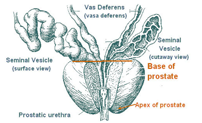 Martin Prostate-BaseEtApex
